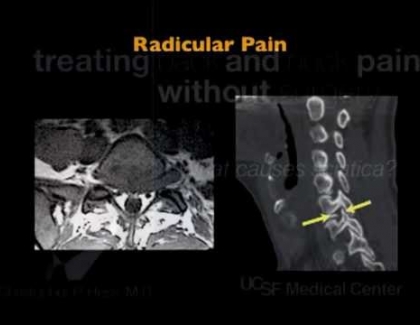 Embedded thumbnail for What causes sciatica? 