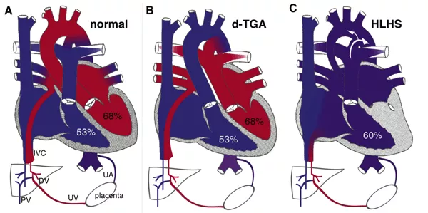 heart diseases illustration