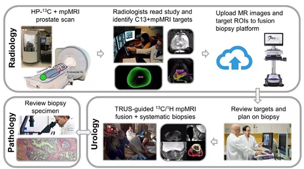 Workflow diagram illustrating a multidisciplinary prostate cancer imaging and biopsy process involving radiology, urology, and pathology. The top row shows MRI and hyperpolarized carbon-13 imaging, radiologist review and target identification, and transfer of imaging data to a biopsy platform. The lower sections depict biopsy planning, image-guided prostate biopsies, pathology review of tissue samples, and coordination between specialists. Arrows connect each step to show the progression from imaging to biopsy and specimen analysis.