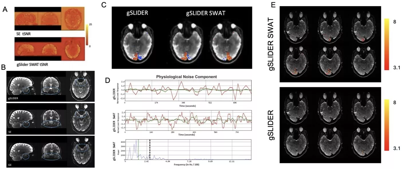 Multi panel MRI figure comparing gSlider SWAT and gSlider sequences. Includes signal to noise maps, activation overlays in occipital cortex, physiological noise plots over time, and axial slices with color coded activation intensity.
