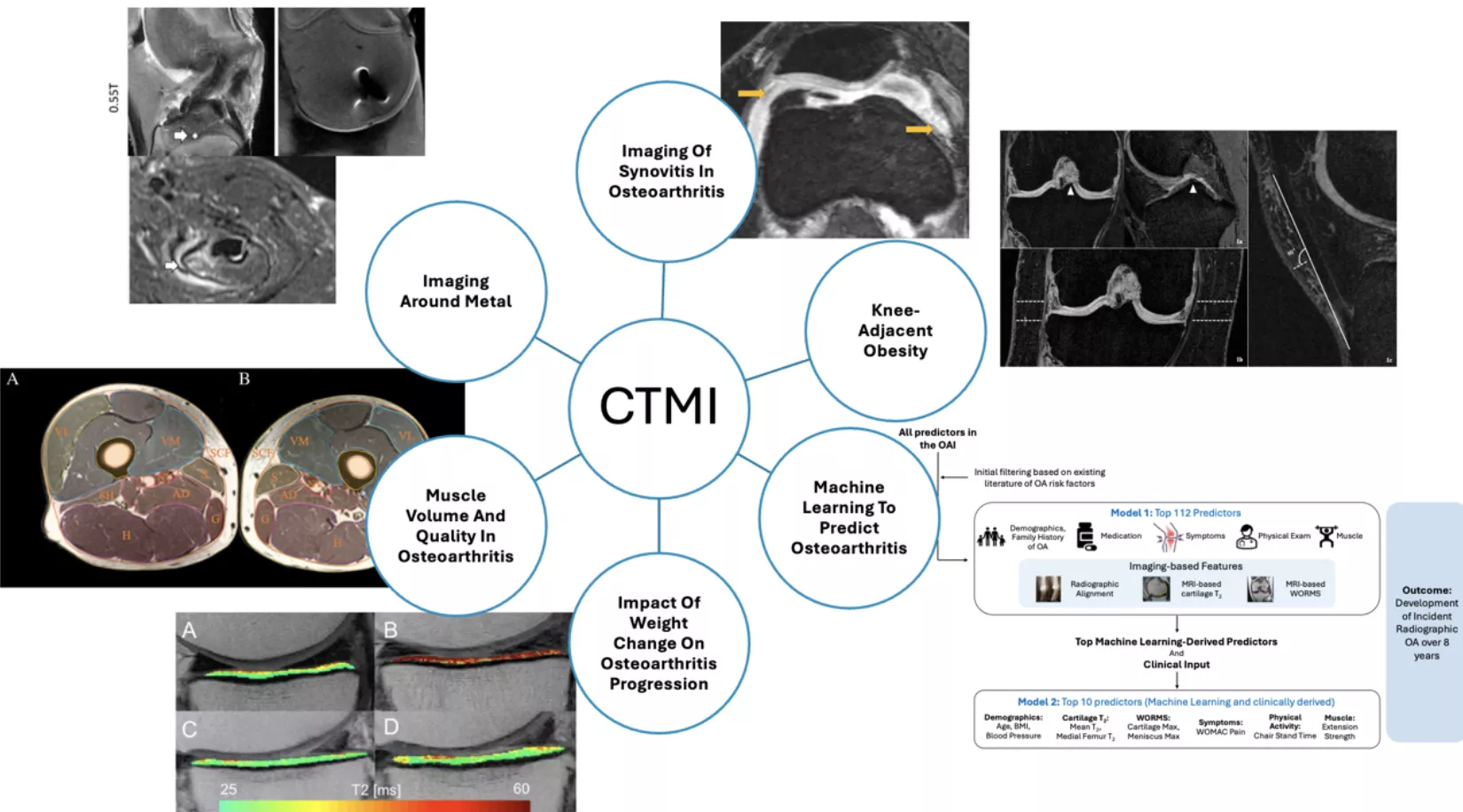 Diagram illustrating the Clinical and Translational MSK Imaging (CTMI) research program with CTMI at the center connected to six research areas: imaging of synovitis in osteoarthritis, knee-adjacent obesity, machine learning to predict osteoarthritis, impact of weight change on osteoarthritis progression, muscle volume and quality in osteoarthritis, and imaging around metal, accompanied by example MRI and imaging analysis images.