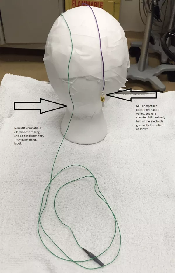 MRI Compatible versus Non-Compatible Electrodes.