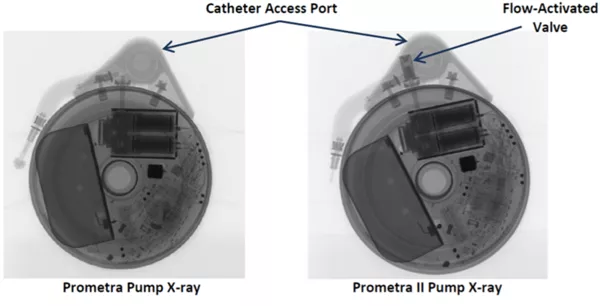 Prometra I and II pumps