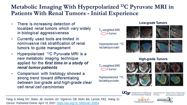 A screenshot of a slide summarizing research on HP 13-C Pyruvate MRI in patients with renal tumors