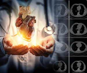 Image composition of a chest CT and a doctor holding up a floating heart.