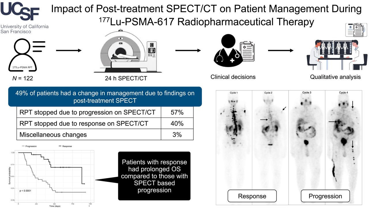 Poster for "Imact of Post-treatment SPECT/CT on Patient Managment"