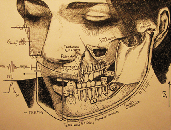 “Dental MRI” – A drawing Dr. Tymofiyeva made to illustrate her PhD work.