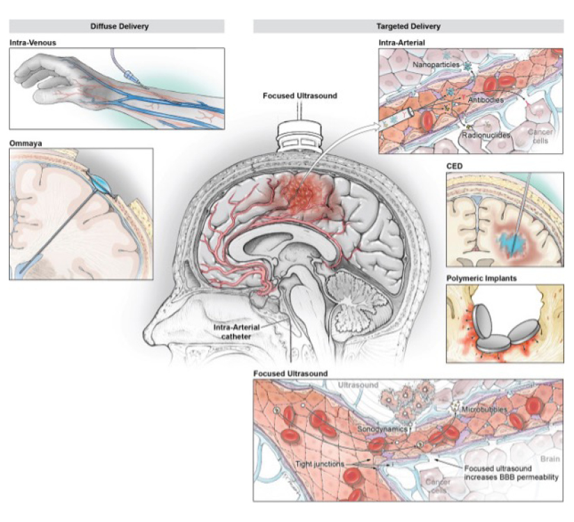 illustration of a persons blood vessels