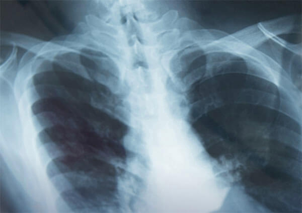 radiographer x rays