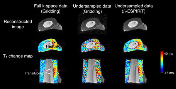 UTE MRI images and T2 Maps