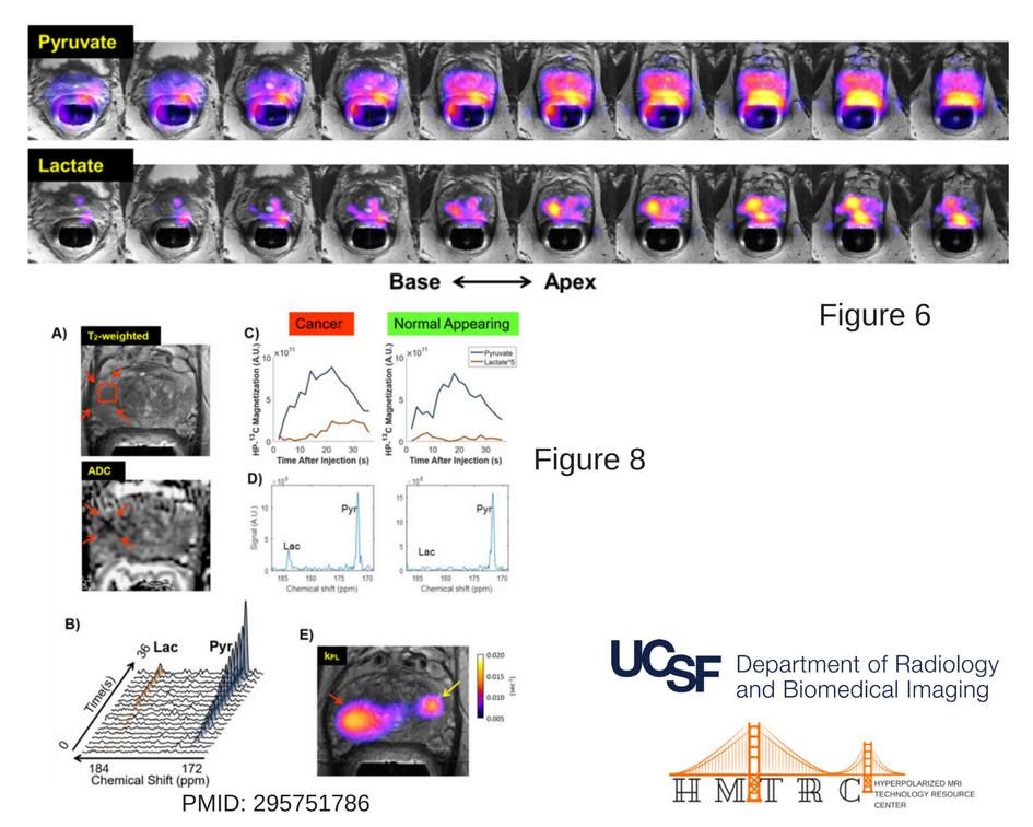 Hyperpolarized MRI Technology Resource Center