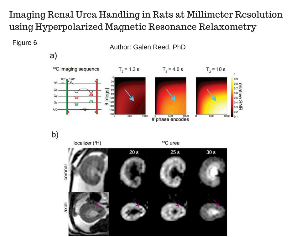 HMTRC Publications And Abstracts | UCSF Radiology