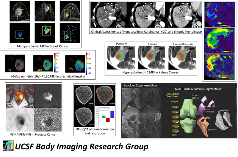 Examples of body imaging scans, including multiparametric MRI in breast cancer, hyperpolarized MRI in kidney cancer, HR-pQCT of bone formation and resorption, clinician assessments of hepatocellular carcinoma (HCC) and chronic liver disease, and PSMA PET/MRI in prostate cancer.