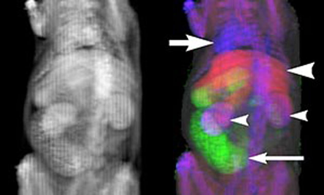 Multi-energy CT and new contrast development - Benjamin Yeh, MD