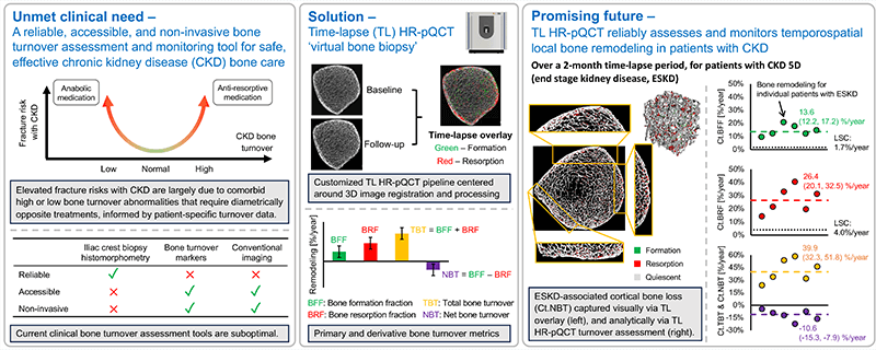 CKD Time-lapse Graphical abstract