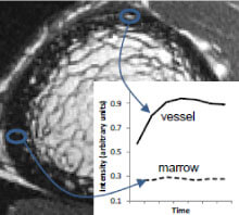 Contrast enhancement curves for regions of hyperintense signal