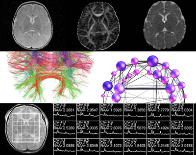 Imaging Research for Neurodevelopment