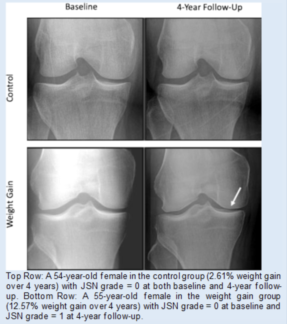 Images of knee bones